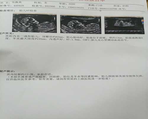 昆明哪个医院能做代孕,南京试管双胎龙凤胎多还