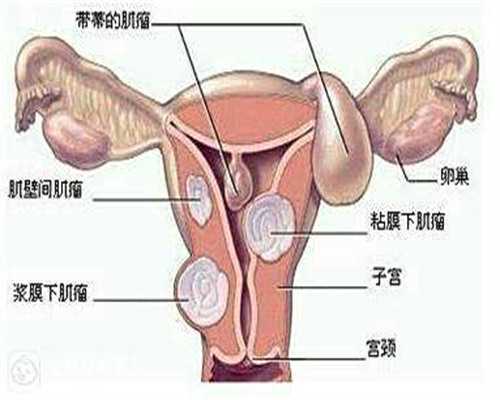 昆明无卵试管生子,昆明试管供卵(温州供卵包男孩)