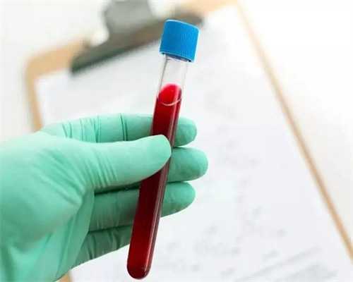 方案解析:长方案降调是人工周期吗?特殊洗精术多少钱